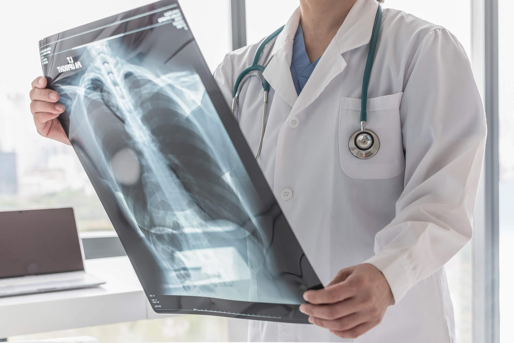 Doctor with radiological chest x-ray film for medical diagnosis on patient's health on asthma, lung disease and bone cancer illness